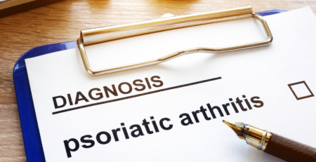 A urgência de definir objetivos no tratamento da artrite psoriática