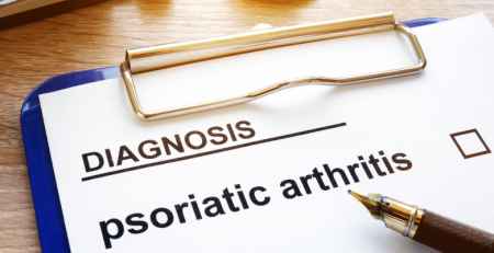 A importância de definir objetivos no tratamento da artrite psoriática