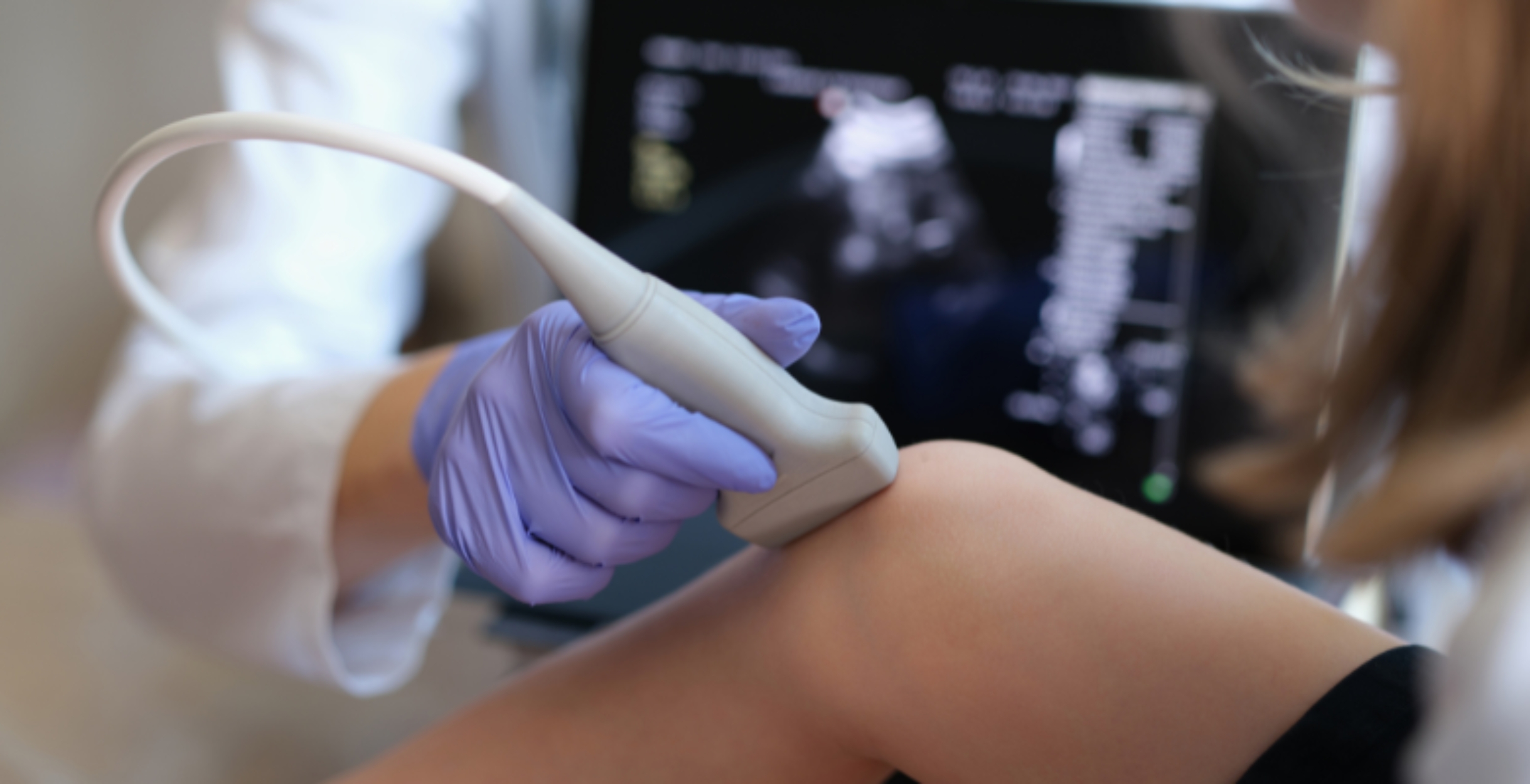 Técnica de ultrassom identifica dois fenótipos de artrite psoriática grave