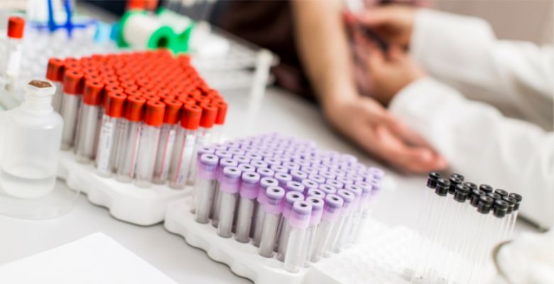 Nefrite lúpica: interleucinas como biomarcadores para prever a gravidade da doença